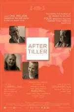 Watch After Tiller Zoechip