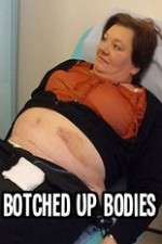 Watch Botched Up Bodies Fmovies